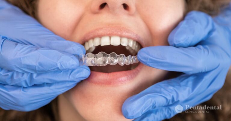 invisalign-ortodoncia-estetica-viladecans