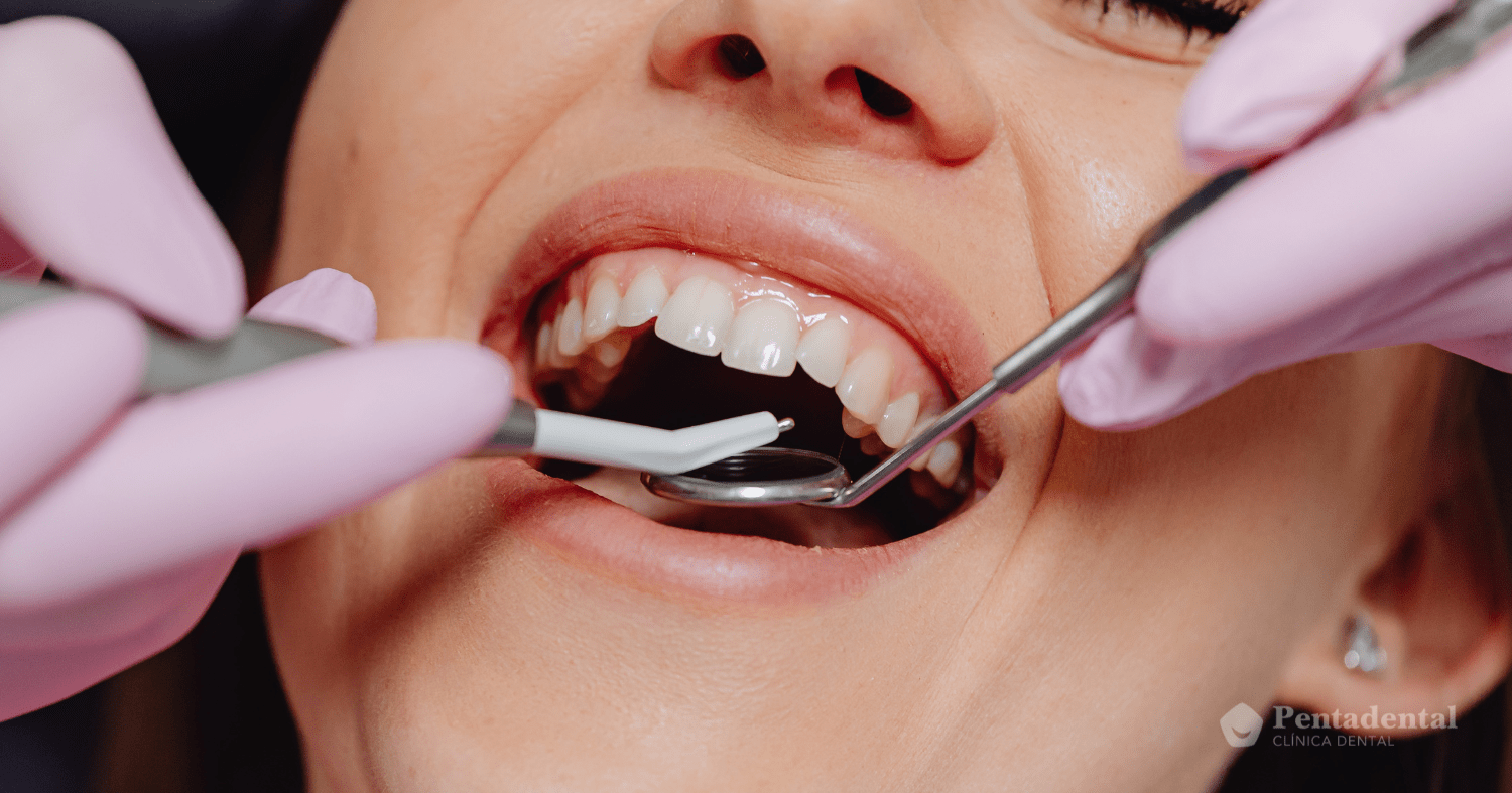 Endodoncia
