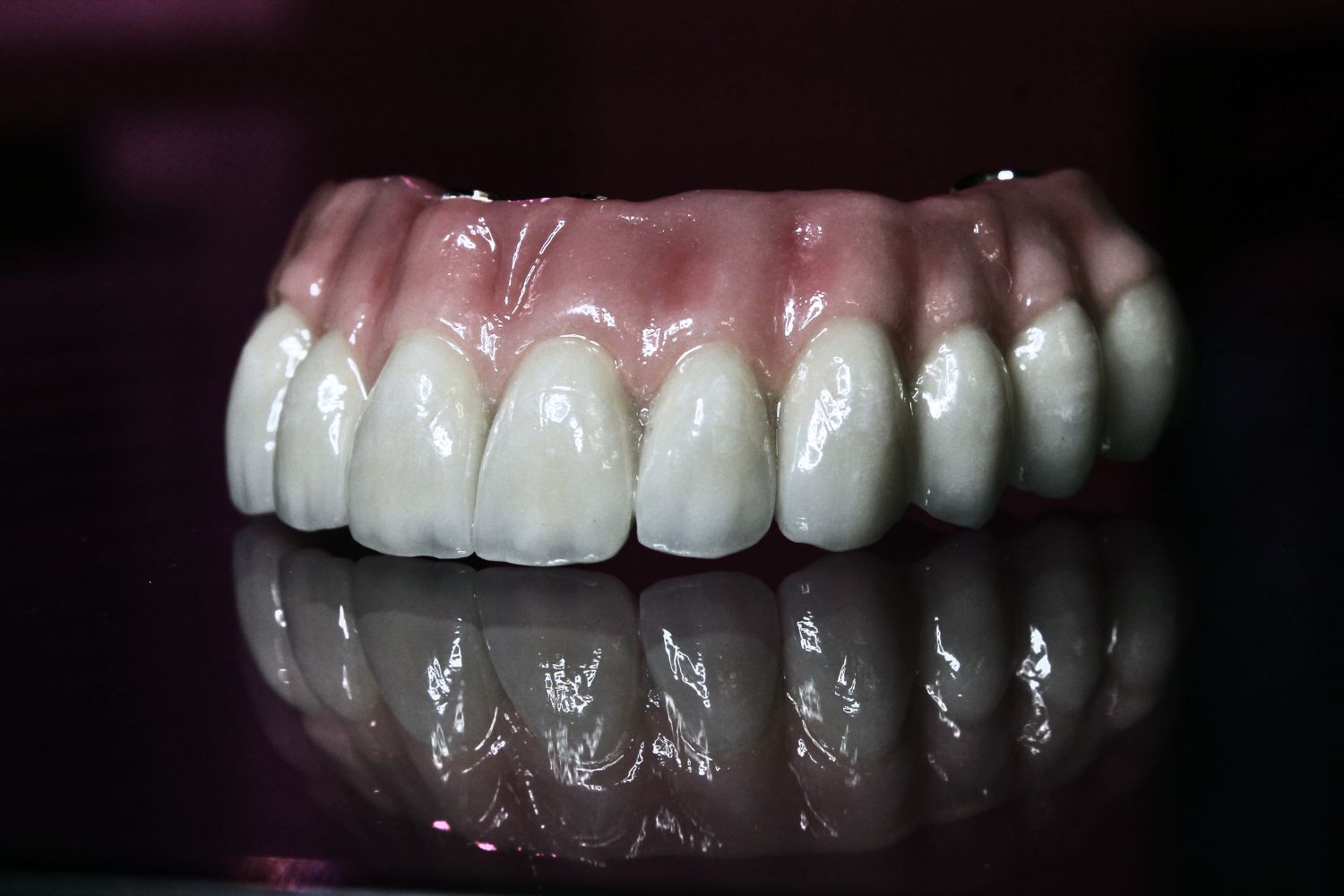 protesis-dentales-en-viladecans-clinica-Pentadental