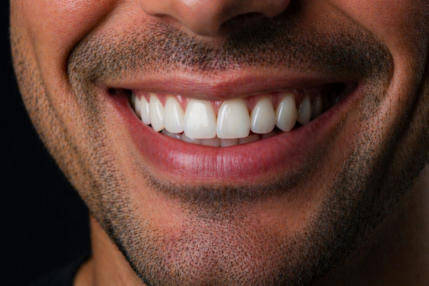 blanqueamiento-dental-en-viladecans
