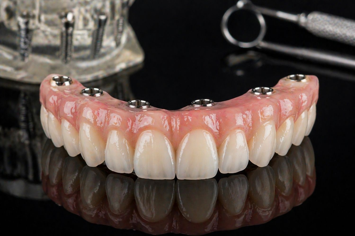 protesis-sobre-implantes-en-viladecans