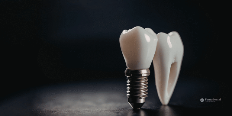 implante dental unitario