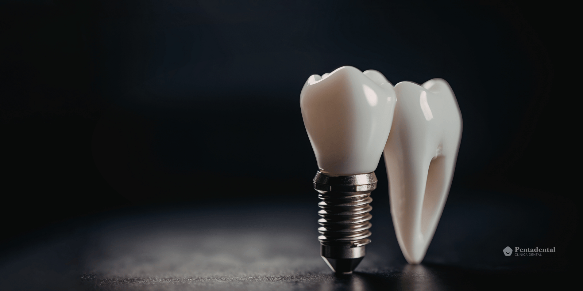 implante dental unitario